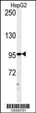 Anti-ATXN2L (C-term) Antibody