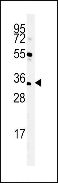 Anti-CU056 (C-term) Antibody