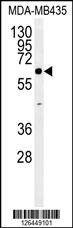 Anti-ERO1LB (C-term) Antibody
