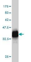 Anti-HBLD2 Antibody