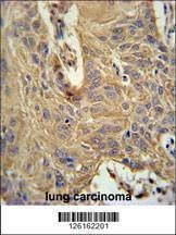 Anti-IL5RA (N-term) Antibody