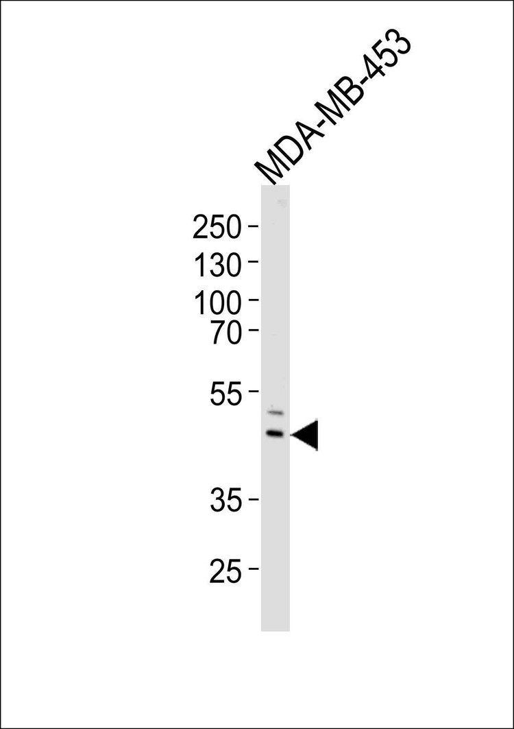 Anti-IL5RA (N-term) Antibody
