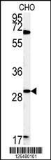 Anti-LHPL2 (C-term) Antibody
