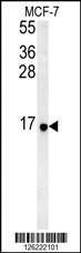 Anti-RPS26 (N-term) Antibody