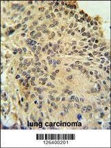 Anti-RSPO2 (C-term) Antibody