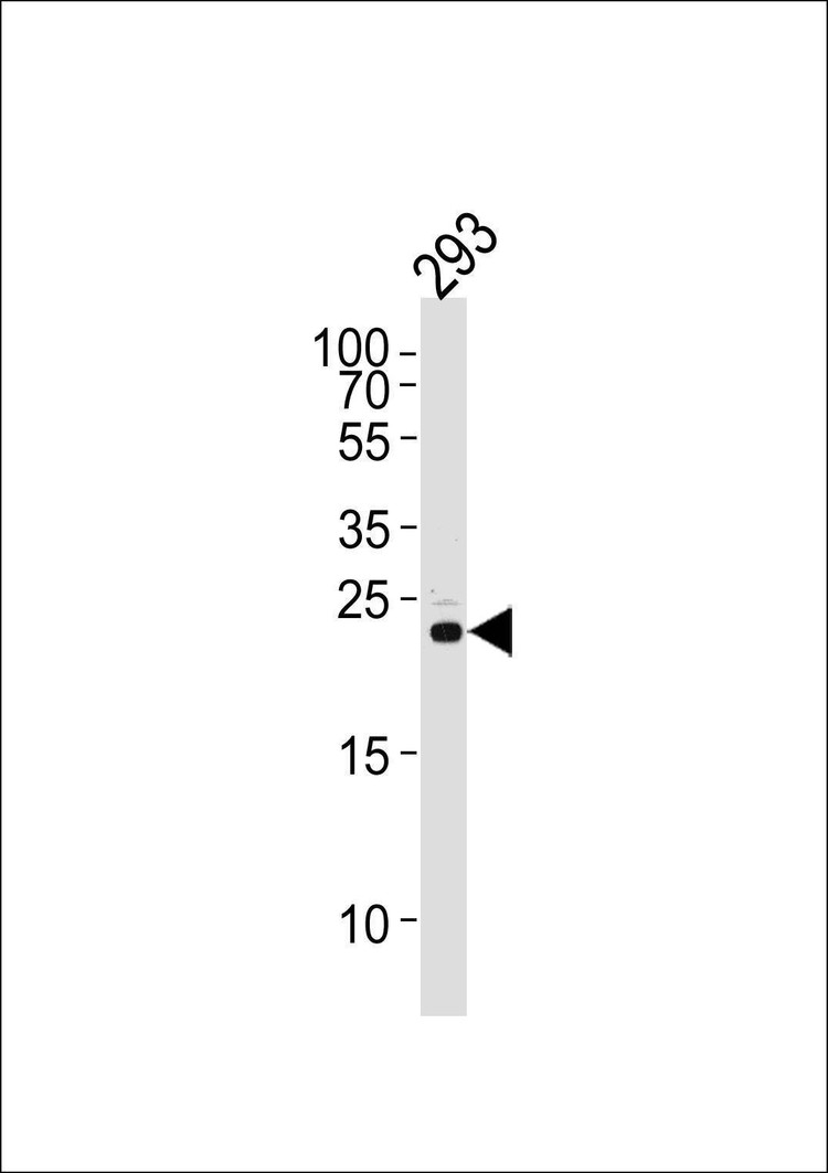 Anti-RSPO2 (C-term) Antibody
