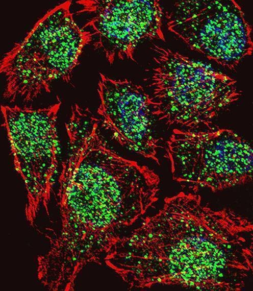 Anti-TSH2 (N-term) Antibody