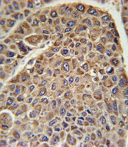 Anti-DLAT (C-term) Antibody