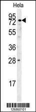 Anti-IDUA (Center) Antibody