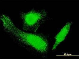 Anti-HD Antibody