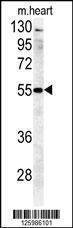 Anti-B4GALT5 (C-term) Antibody