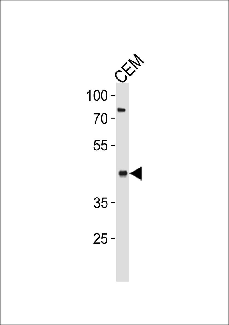 Anti-FADS2 (Center) Antibody