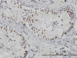 Anti-HDAC1 Antibody
