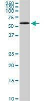 Anti-HDAC1 Antibody