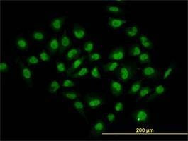 Anti-HDAC1 Antibody