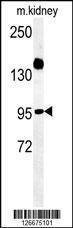 Anti-ARMC5 (C-term) Antibody