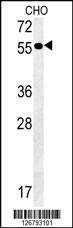 Anti-AMY2A (C-term) Antibody