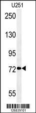 Anti-DEPDC1 (N-term) Antibody