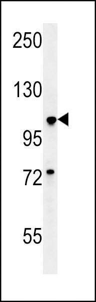 Anti-BUB1A (N-term) Antibody