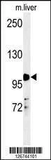 Anti-NR3C1 (Center) Antibody