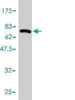 Anti-HDAC11 Antibody