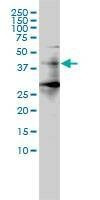 Anti-HDAC11 Antibody