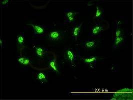 Anti-HDAC11 Antibody
