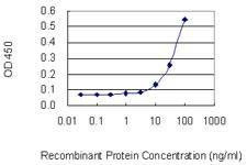 Anti-HDAC11 Antibody