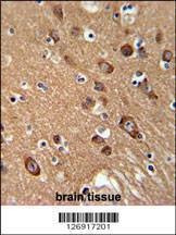 Anti-SYT13 (N-term) Antibody