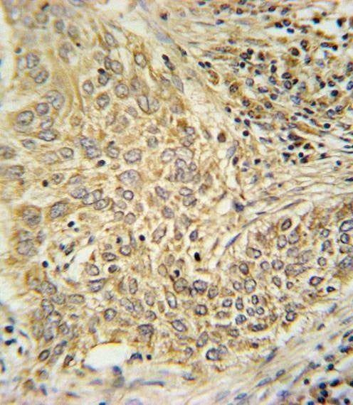 Anti-AHR (Center) Antibody