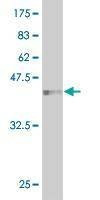 Anti-HEMK2 Antibody