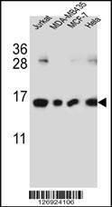 Anti-H2AFJ (N-term) Antibody