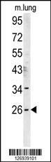 Anti-DNJC8 (C-term) Antibody