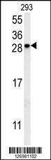 Anti-KCT2 (Center) Antibody