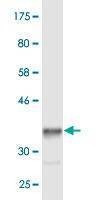 Anti-HERC3 Antibody