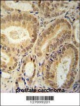Anti-RBM24 (N-term) Antibody
