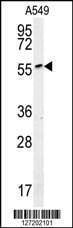 Anti-ALG10B (C-term) Antibody