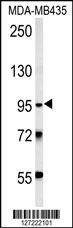 Anti-TRHDE (C-term) Antibody