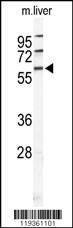 Anti-HABP2 (C-term) Antibody