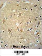 Anti-P2RX7 (C-term) Antibody