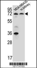 Anti-P2RX7 (C-term) Antibody