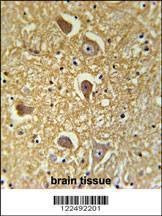 Anti-HAS2 (Center) Antibody