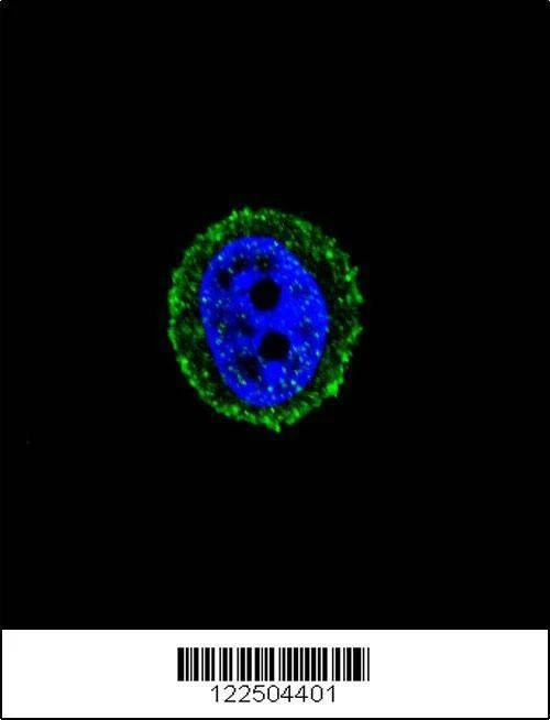 Anti-CALCR (C-term) Antibody