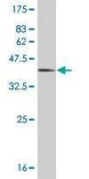 Anti-HEY1 Antibody