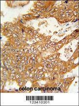 Anti-FBXO34 (C-term) Antibody