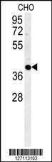 Anti-CCYL1 (N-term) Antibody
