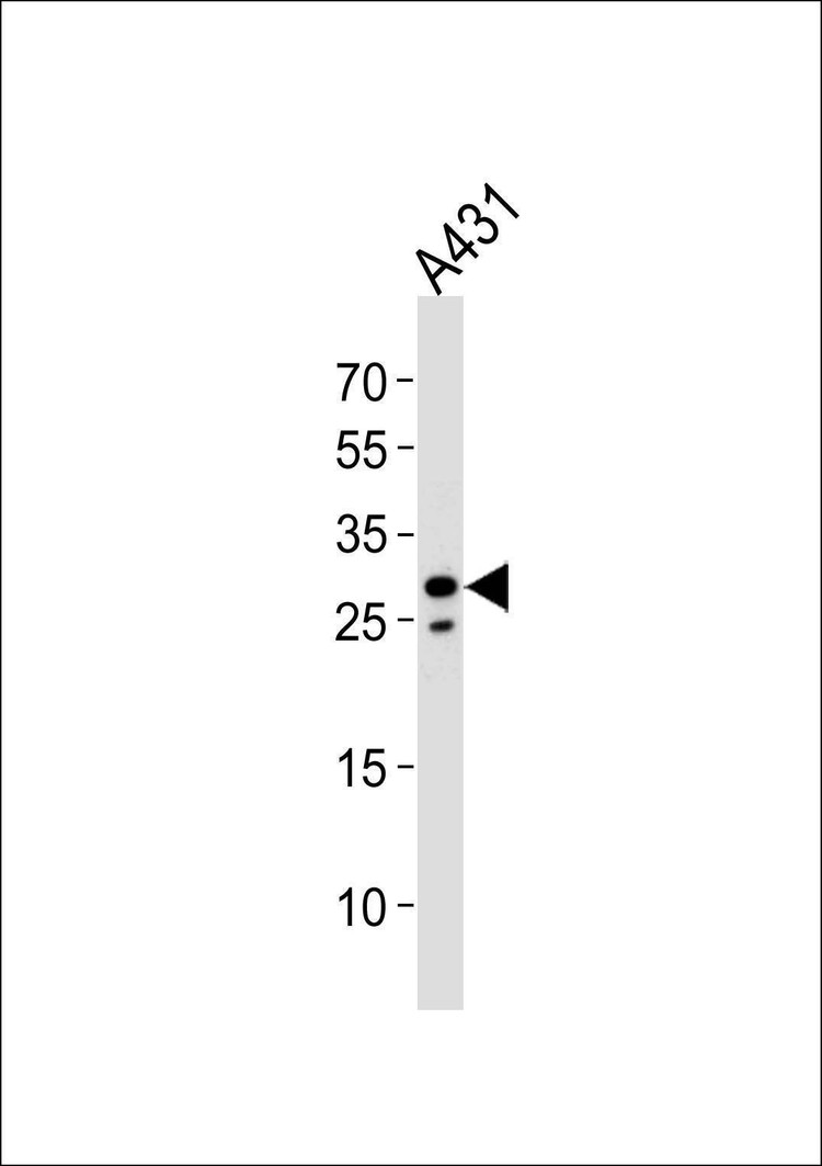 Anti-RNF208 (Center) Antibody
