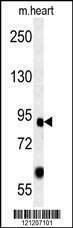 Anti-FOXP2 (C-term) Antibody