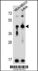Anti-KIR2DL2 (C-term) Antibody