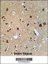 Anti-AFTPH (C-term) Antibody